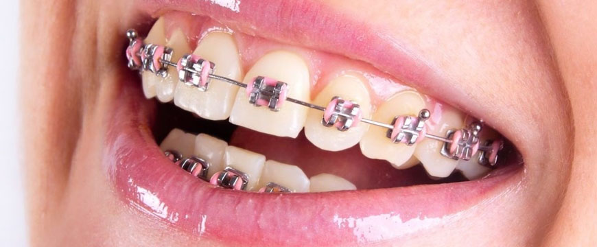 Orthodontics2